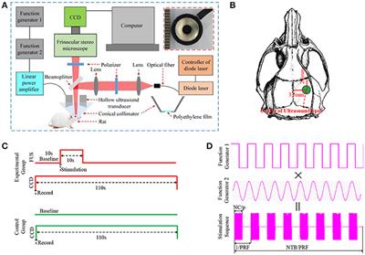 Cortical Hemodynamic Responses Under Focused Ultrasound Stimulation Using Real-Time Laser Speckle Contrast Imaging